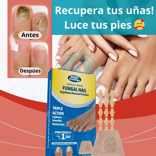 Parche de hongos para pies